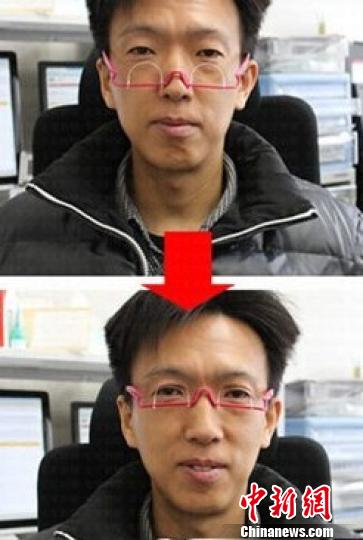 “雙眼皮眼鏡”受熱捧醫(yī)生稱配戴不慎損傷眼皮（圖）