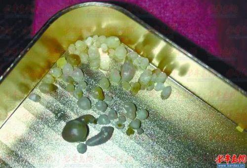 買生蠔吃出珍珠 細數那些吃出的意外之財（圖）